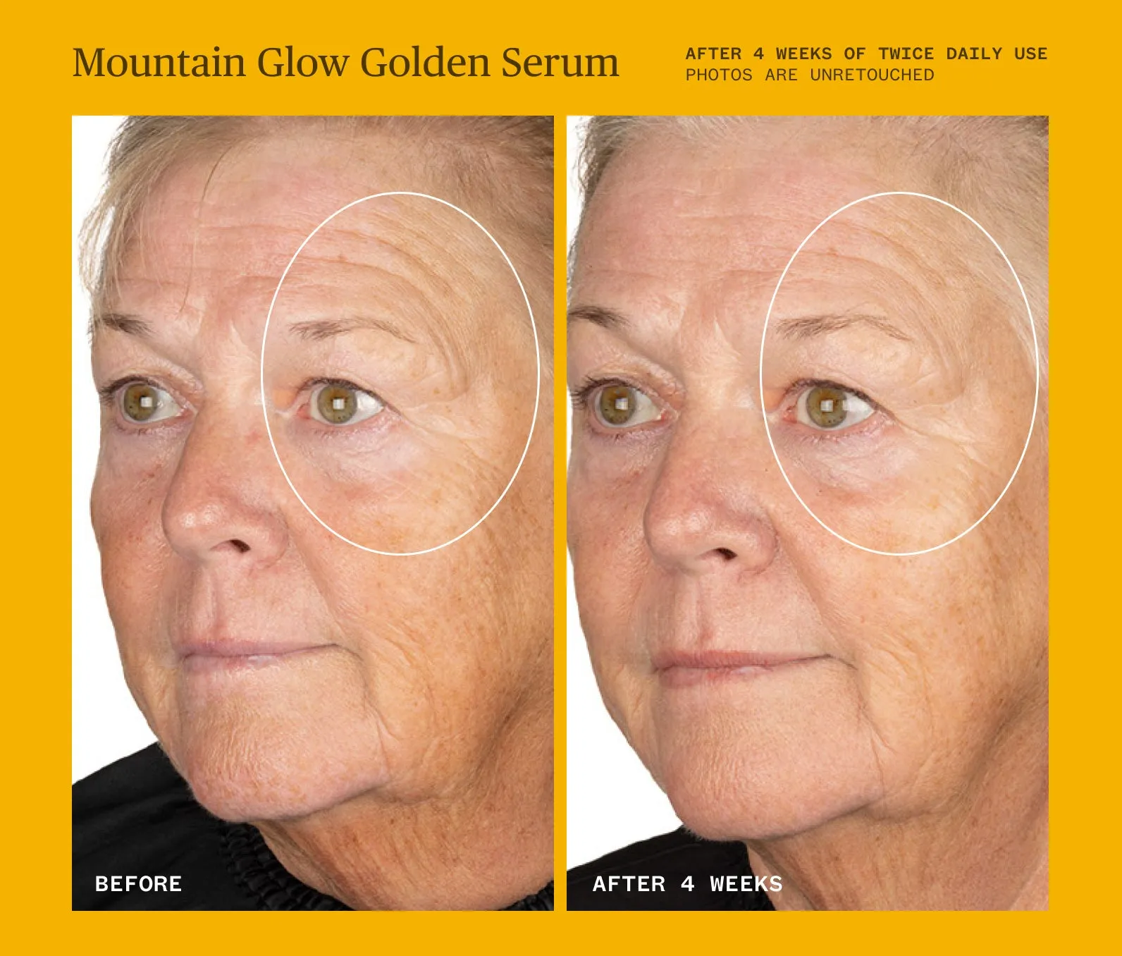 Mountain Glow Golden Serum