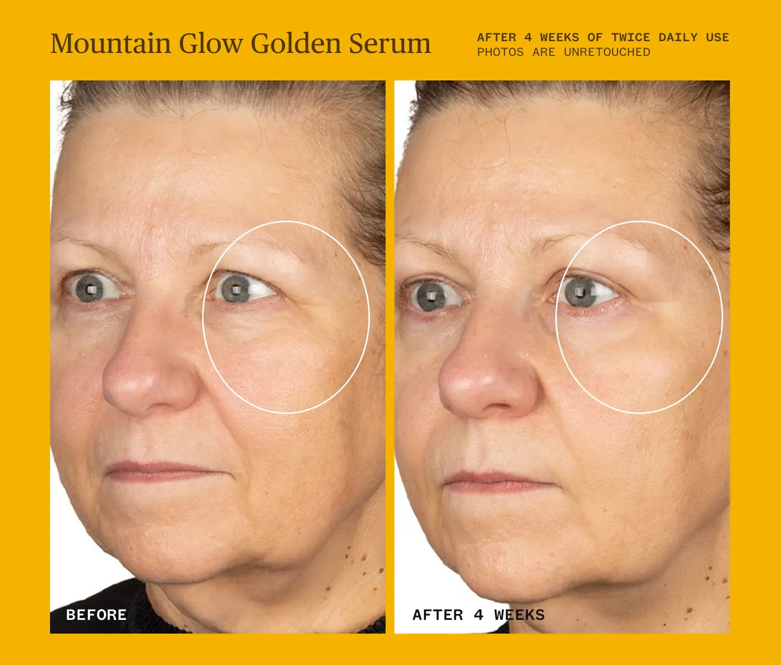 Mountain Glow Golden Serum